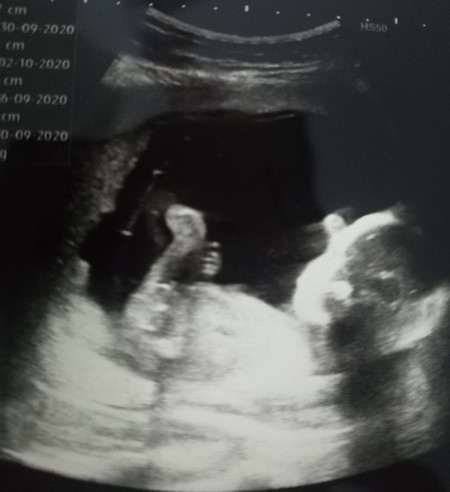 ลองทายกันเล่นๆนะคะ