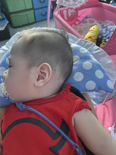 หัวของลูกน้อย