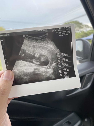 18weekกว่า