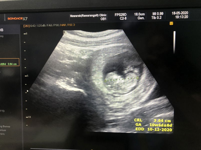 Faii Napa profile icon