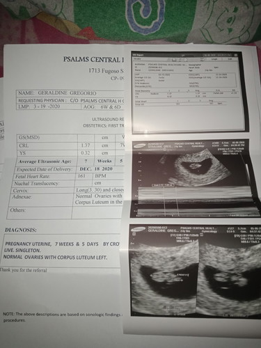 7w5d