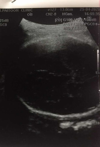 ทีมมิถุนายน