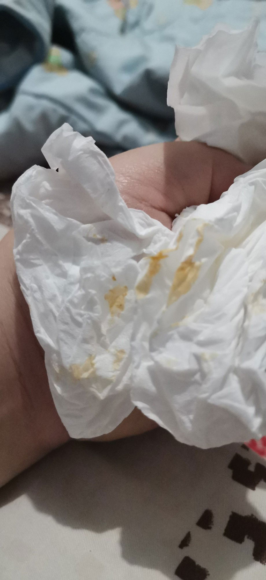 Flek Coklat Setelah BAB