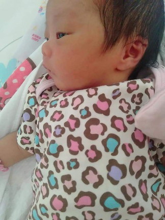 ใบหูลูกสาวพับ