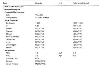 urinalyis result..