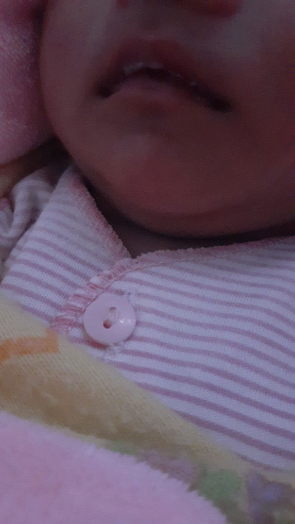 sariawan pada bayi.. bagaimana cara menanganinya