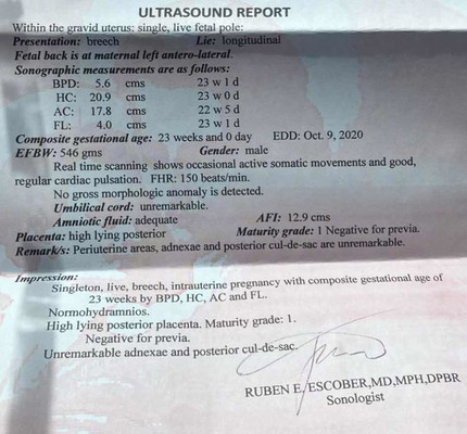 Help sa Ultrasound