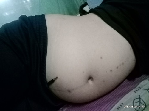 ขอดูท้องแม่ท้อง29วีคหน่อยคะ