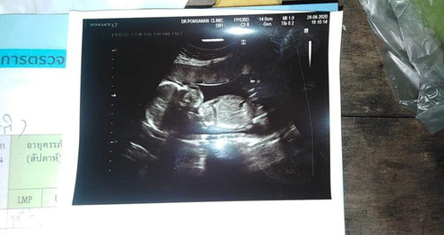 20weekแล้วจร้า