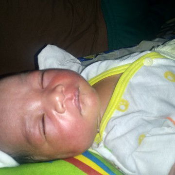 Muka Bayi merah, umur 2 hari