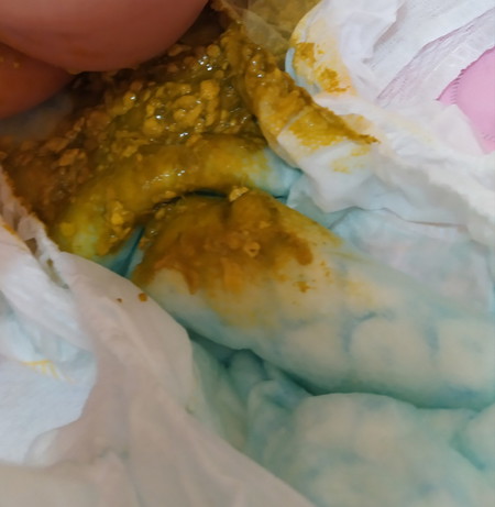 baby poop.. is it normal?