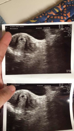 Kandungan 6 weeks.