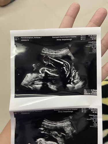 ลูกสาว🥰