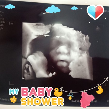 คลอดเดือนเดียวกับแม่