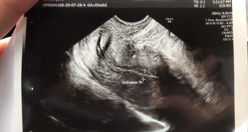 Dinding rahim nipis ?