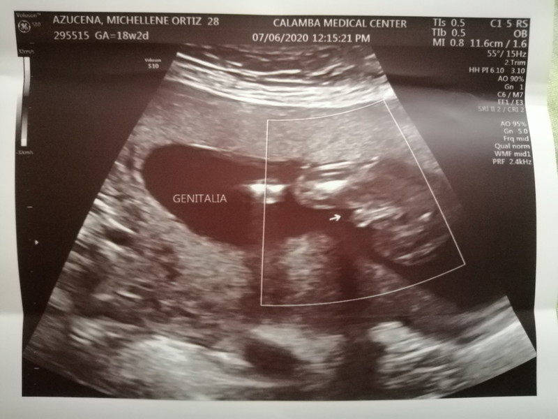 baby-boy-at-18weeks-so-happy-to-know-my-gender-as-early-as