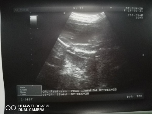 ซาวด์มาหมอบอกได้ลูกชาย