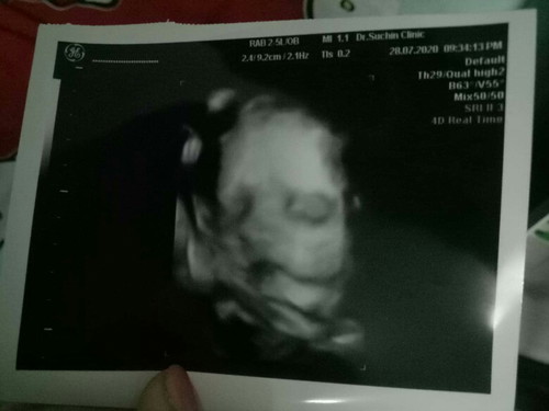 28W5D
