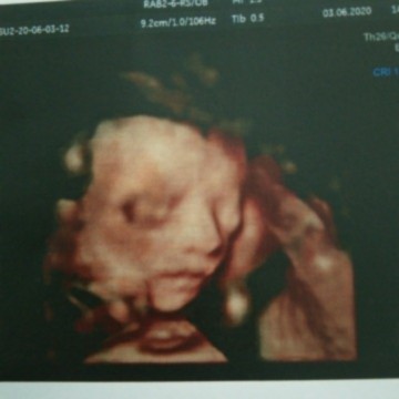ลูกสาว