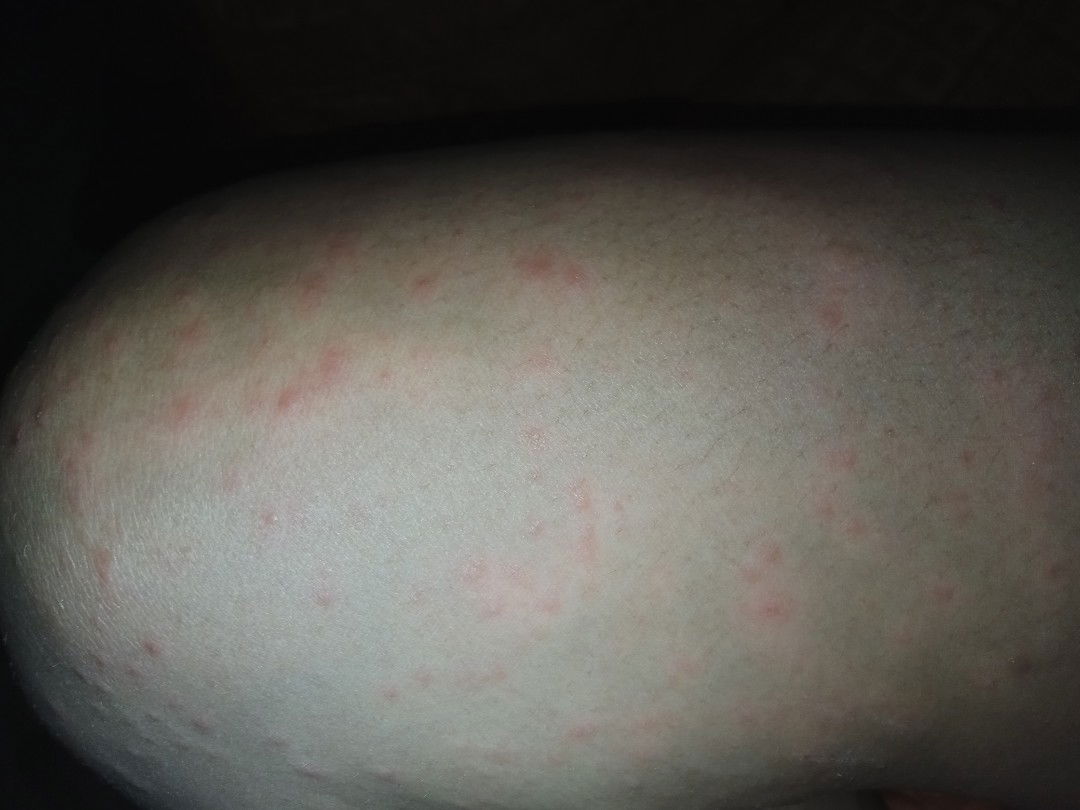 Natural lang po ba o hindi?