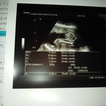 ปรึกษา​ สอบถามค่ะ