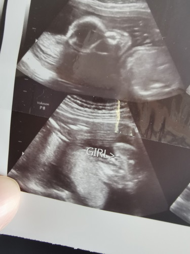 แบบนี้ ลูกสาวชัวร์ไหมค่ะ 😊