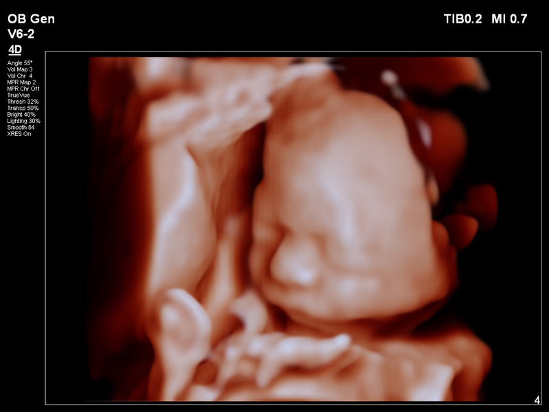 Mommy to be profile icon