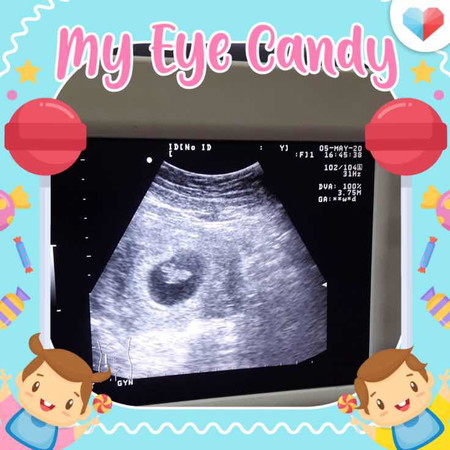 ตอนนี้ท้องได้ 9 สัปดาห์คะ ยังไม่มีอาการแพ้ท้องเลย