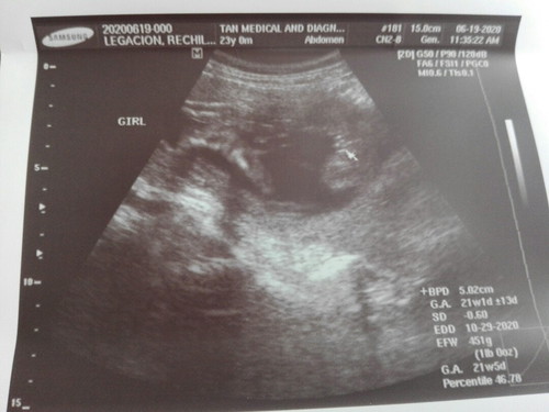 It's a Girl❤
