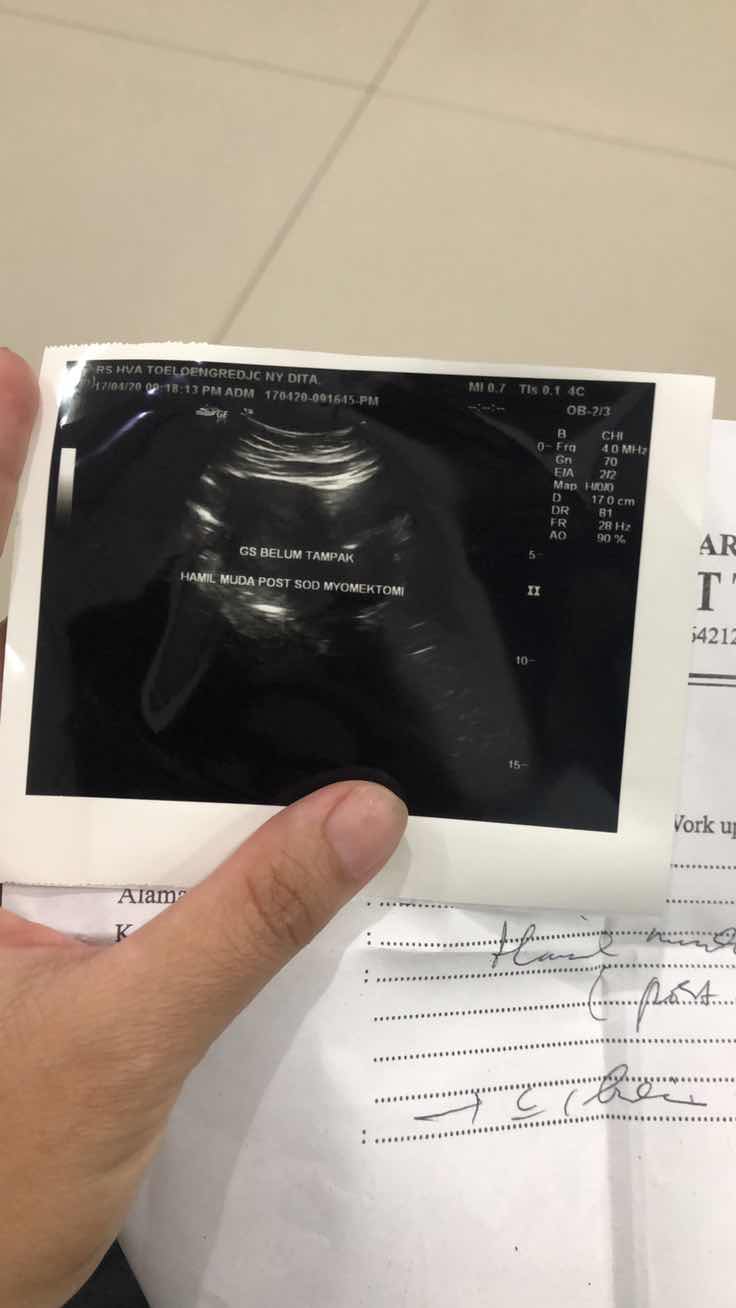 Kantung bayi belum terlihat