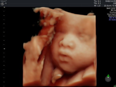 31w