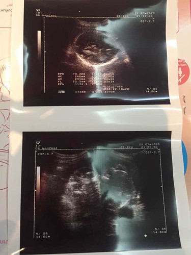 27W4D❤️