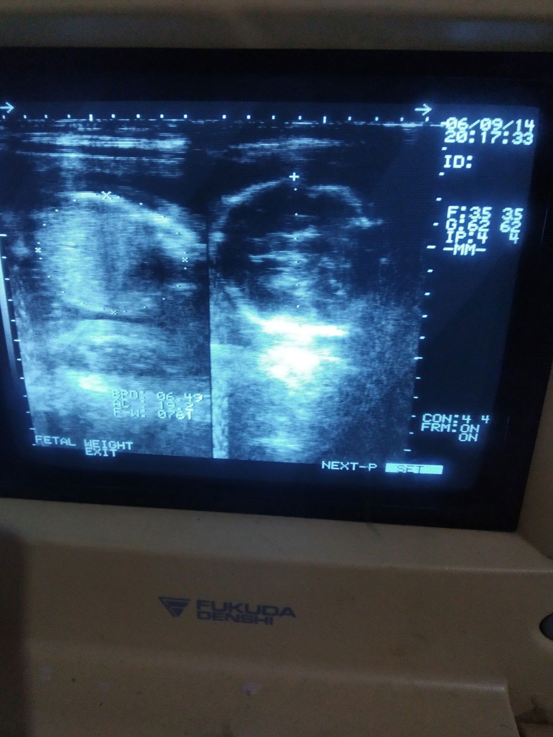 eka tusnawati indah purnamasari profile icon