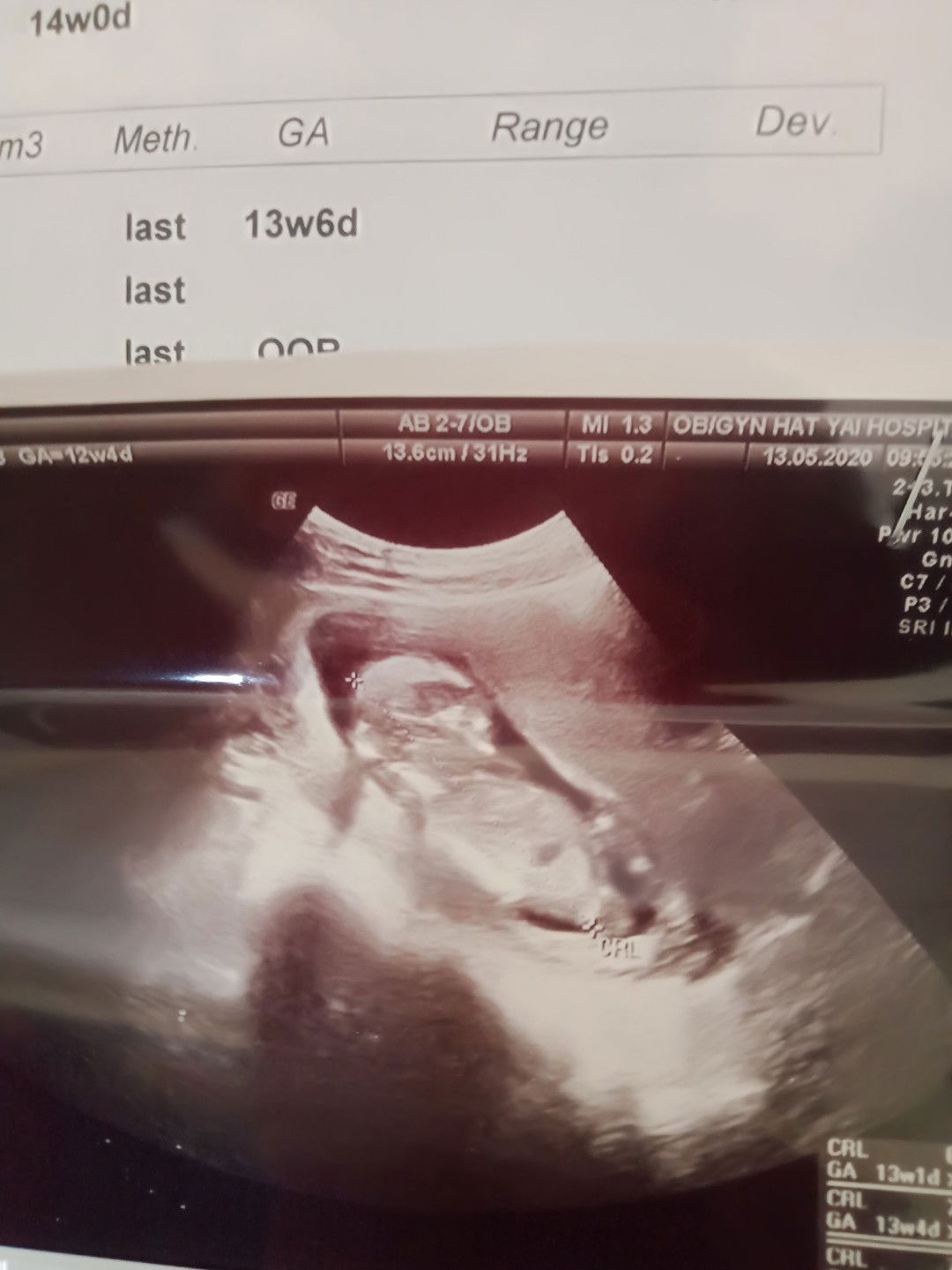 ท้อง 13 สัปดาห์ 6วัน น้ำหนักลูก 92g ไม่ทราบว่ามันตามเกณฑ์หรือเปล่า แม่ๆที่รู้ช่วยบอกหน่อยนะคะ# ท้องแรกค่ะ