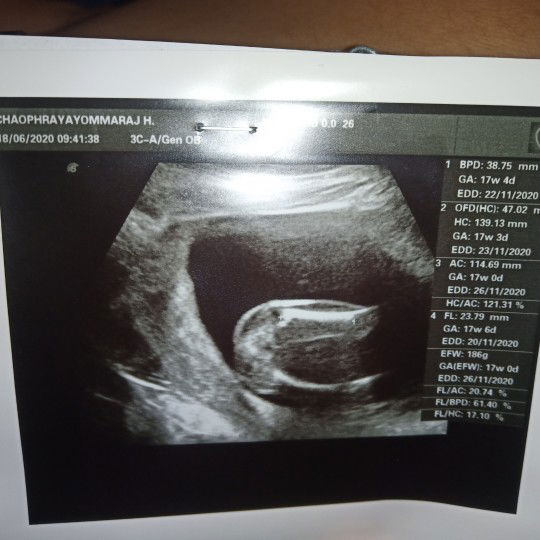 ช่วยส่องเพศหนูน้อยทีคะ☺☺