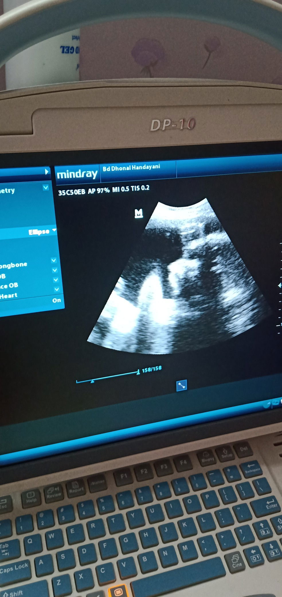 Mirdiani Apriyanti profile icon