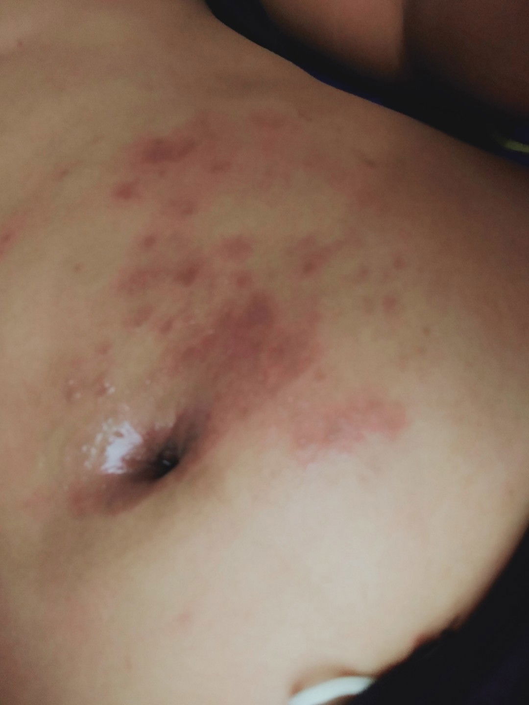 alergi atau bawaan bayi