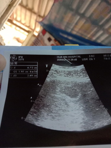 อยากรู้ว่าลูกเล็กเกินไหมค่ะ ช่วยให้คำแนะนำที