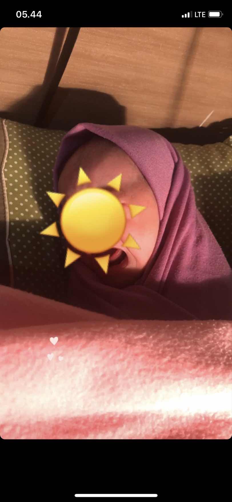 Ketuban pecah dini (kpd)