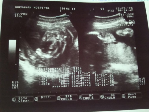 หญิงหรือชาย