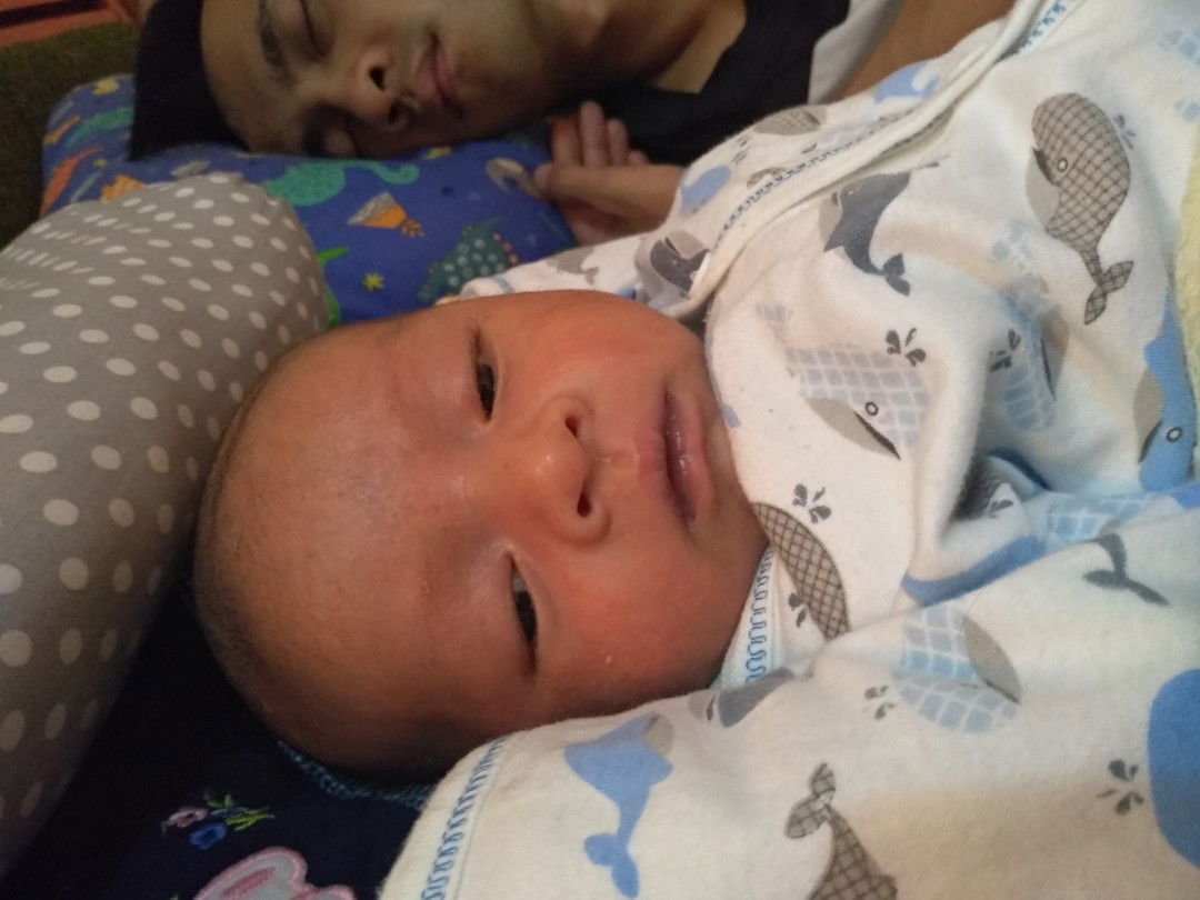 Bibir Bayi Menjadi Hitam