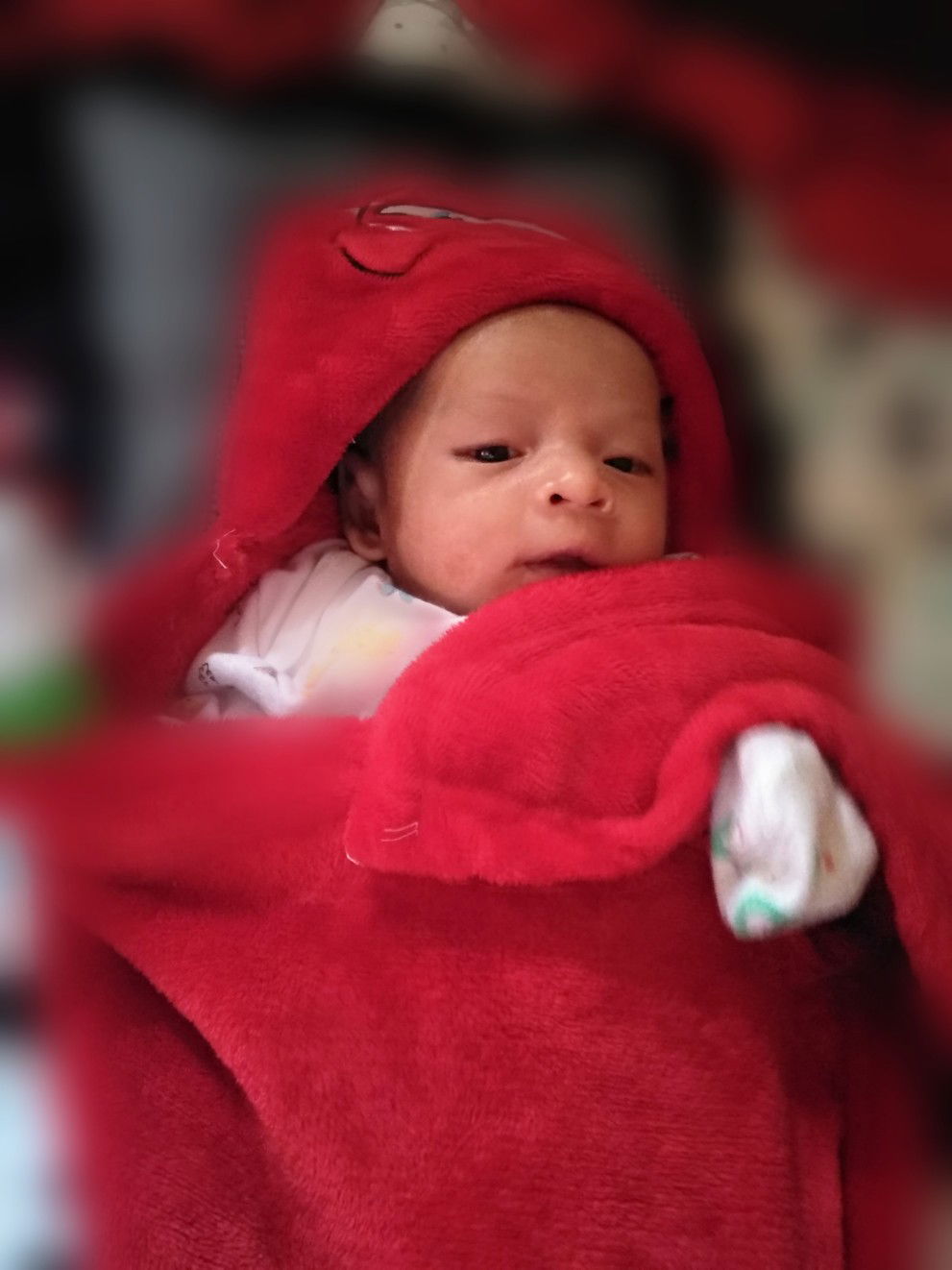 Bayi 1 bulan harus di sunat?