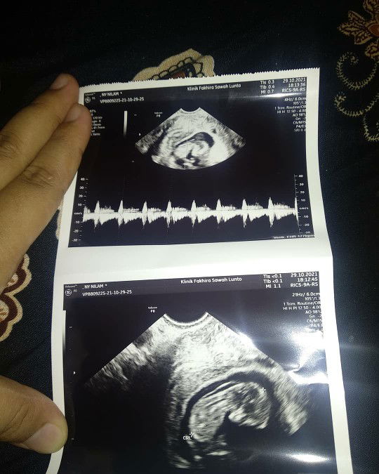 Nilam ahmad profile icon