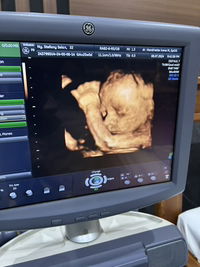 Gladys Nahak profile icon