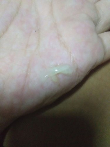 ถ้าเป็นแบบนี้เยอะๆเราจะเป็นอะไรไหมค่ะ