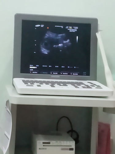 กลัวท้องลมค่ะ