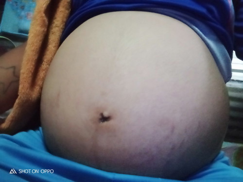 ท้องแบบนี้จะได้ลูกผู้หญิงหรอผู้ชายค่ะ