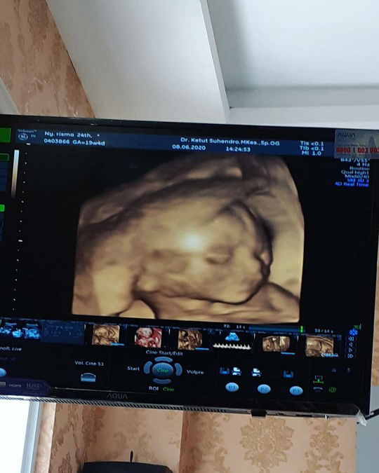 Risma Aprianii profile icon