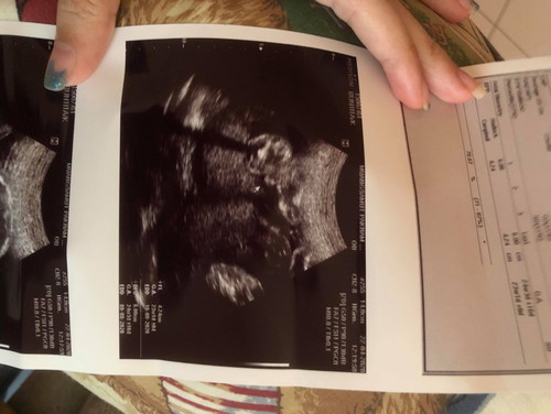 ดูเพศน้องตรงไหนค่ะ