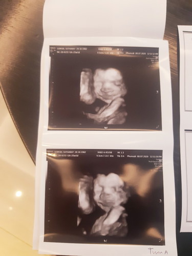 มาแล้วลูกแฝดของแม่